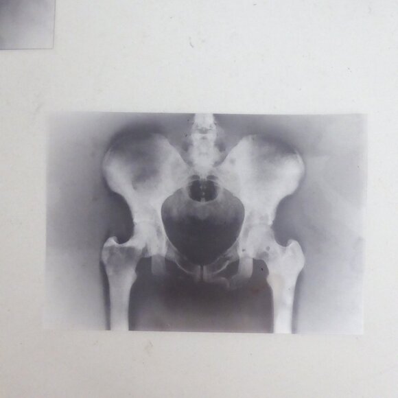 6” x 4” 24 HALLOWEEN ACETATE PLASTIC PAPER X-RAY IMAGE PAD - Picture 8 of 10